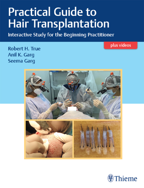 Practical Guide to Hair Transplantation 