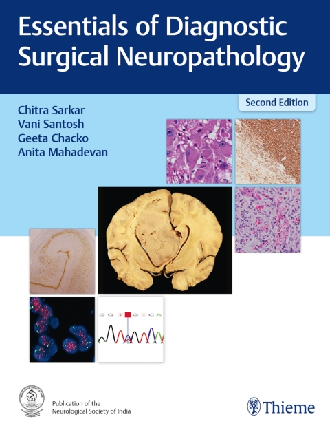 Cover image for book Essentials of Diagnostic Surgical Neuropathology