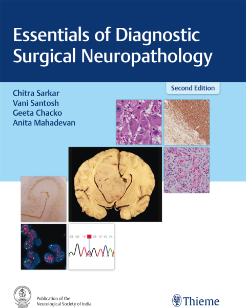 Cover image for book Essentials of Diagnostic Surgical Neuropathology