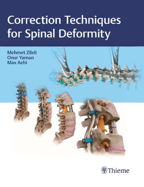 Cover image for book Correction Techniques for Spinal Deformity