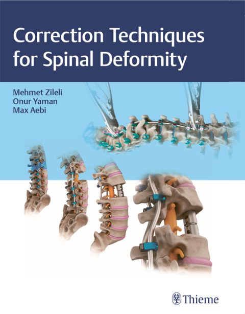 Cover image for book Correction Techniques for Spinal Deformity