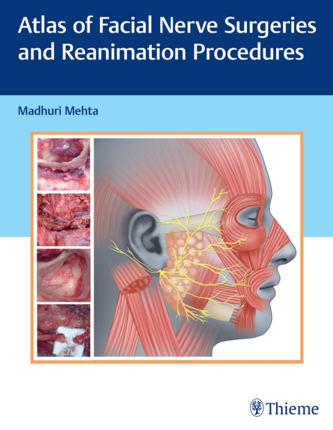 Cover image for book Atlas of Facial Nerve Surgeries and Reanimation Procedures
