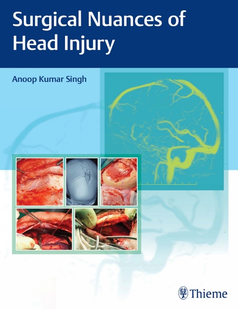 Cover image for book Surgical Nuances of Head Injury