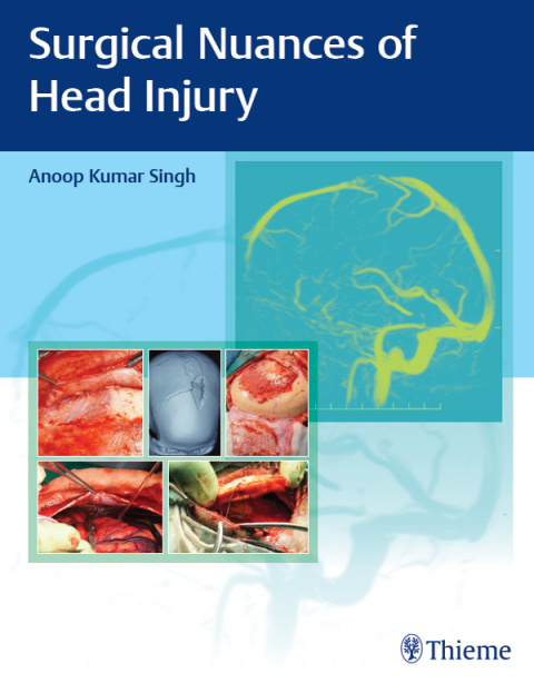 Cover image for book Surgical Nuances of Head Injury