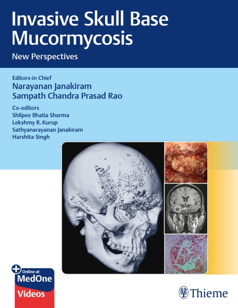 Cover image for book Invasive Skull Base Mucormycosis