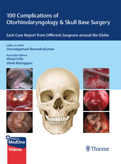 Cover image for book 100 Complications of Otorhinolangyngology & Skull Base Surgery