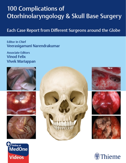 Cover image for book 100 Complications of Otorhinolangyngology & Skull Base Surgery