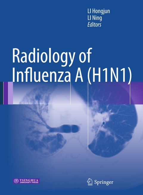 Cover image for book Radiology of Influenza A (H1N1)