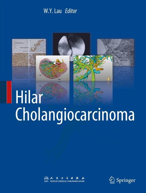 Cover image for book Hilar Cholangiocarcinoma