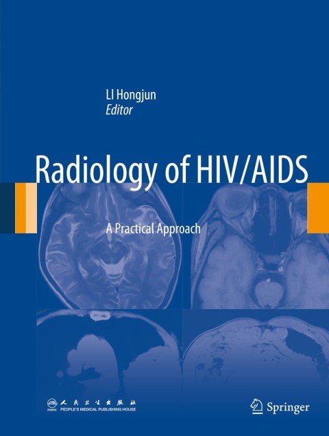 Cover image for book Radiology of HIV/AIDS