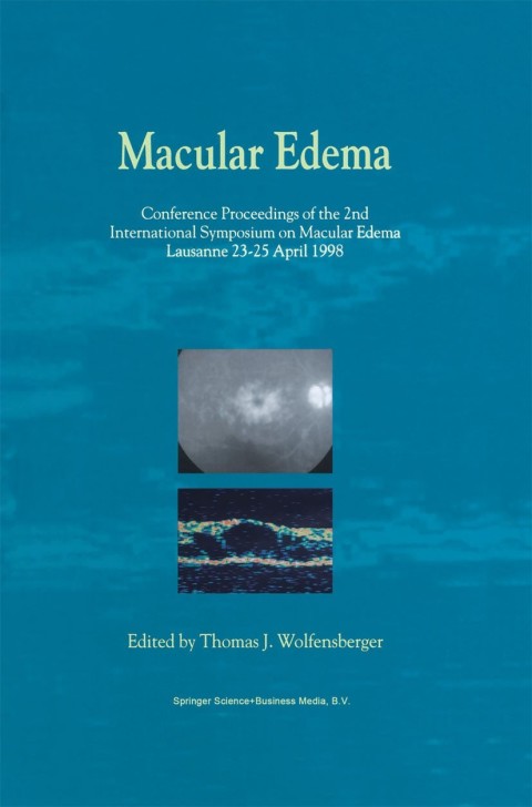 Cover image for book Macular Edema