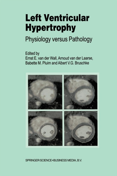 Cover image for book Left Ventricular Hypertrophy