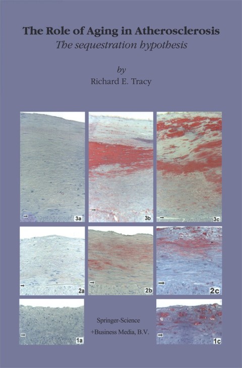 Cover image for book The Role of Aging in Atherosclerosis