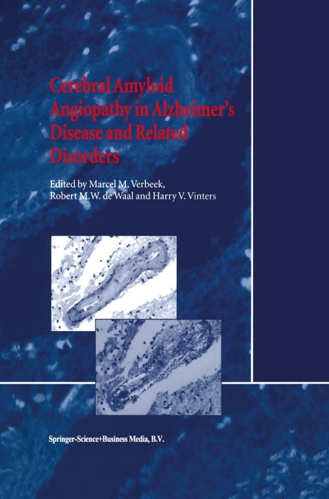 Cover image for book Cerebral Amyloid Angiopathy in Alzheimer’s Disease and Related Disorders