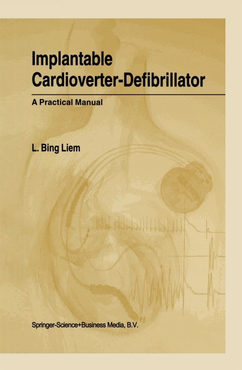 Cover image for book Implantable Cardioverter-Defibrillator