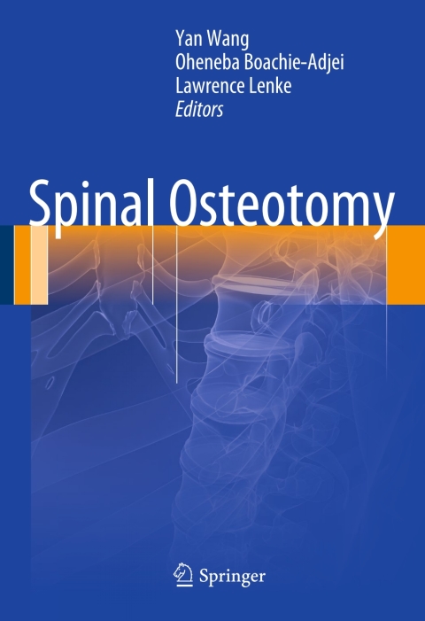 Cover image for book Spinal Osteotomy
