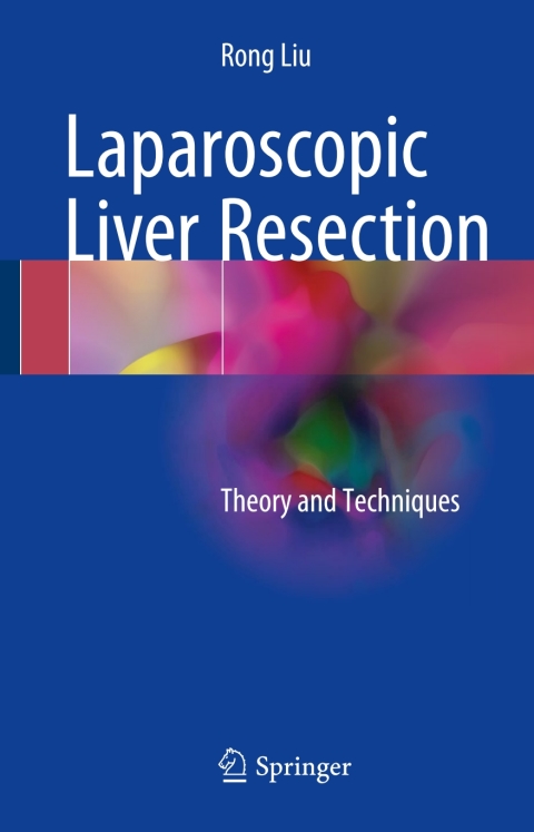 Cover image for book Laparoscopic Liver Resection