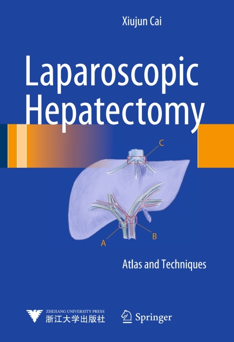 Cover image for book Laparoscopic Hepatectomy