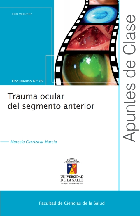 Cover image for book Trauma ocular del segmento anterior
