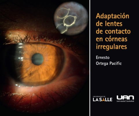 Cover image for book Adaptación de lentes de contacto en córneas irregulares