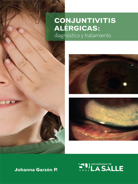 Cover image for book Conjuntivitis alérgicas: Diagnóstico y tratamiento
