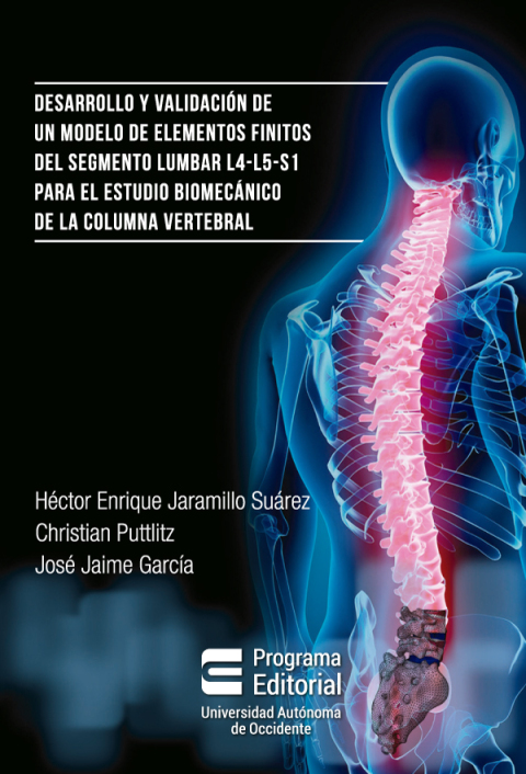 Cover image for book Desarrollo y validación de un modelo de elementos finitos del segmento lumbar l4-l5-s1 para estudio biomecánico de la columna vertebral.