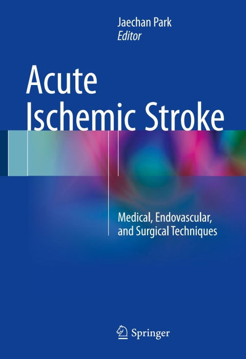 Cover image for book Acute Ischemic Stroke