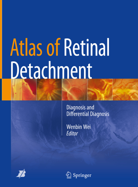 Cover image for book Atlas of Retinal Detachment