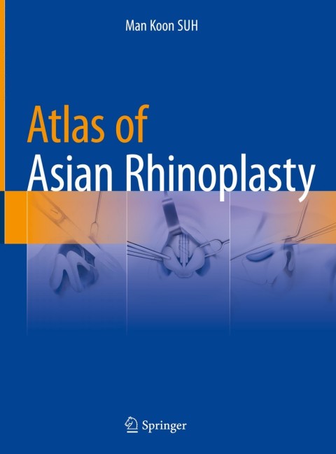 Cover image for book Atlas of Asian Rhinoplasty