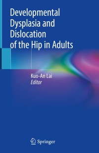 Developmental Dysplasia and Dislocation of the Hip in Adults ...