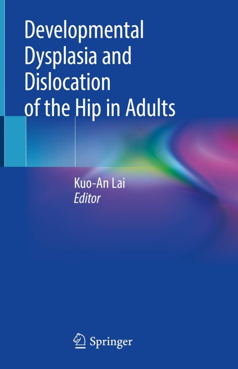 Cover image for book Developmental Dysplasia and Dislocation of the Hip in Adults