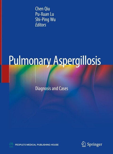 Cover image for book Pulmonary Aspergillosis
