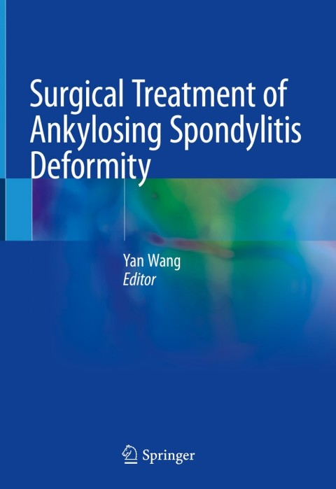 Cover image for book Surgical Treatment of Ankylosing Spondylitis Deformity