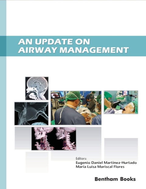 Cover image for book An Update on Airway Management
