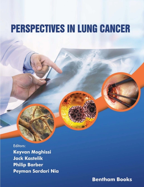 Cover image for book Perspectives in Lung Cancer