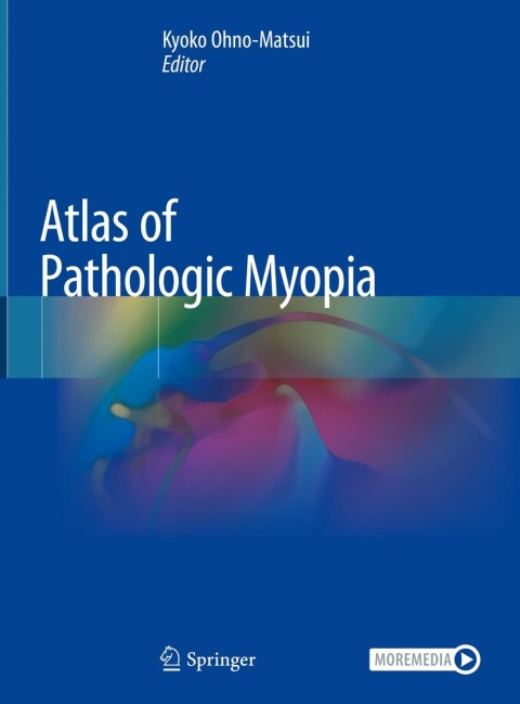Cover image for book Atlas of Pathologic Myopia