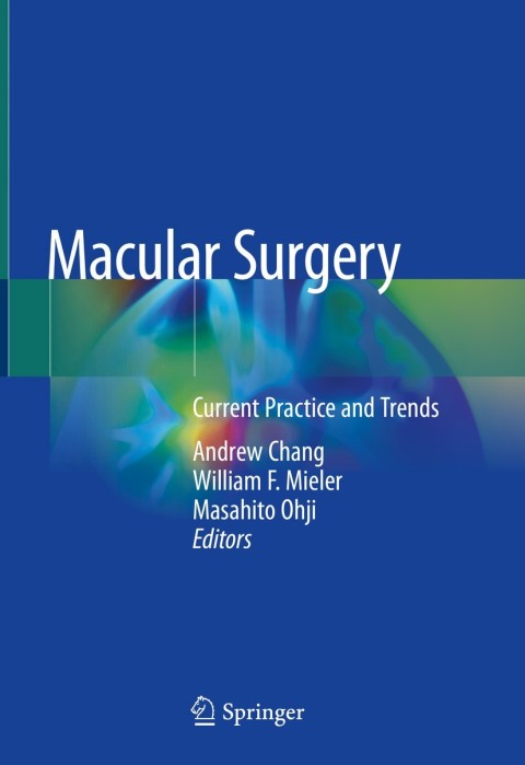 Cover image for book Macular Surgery