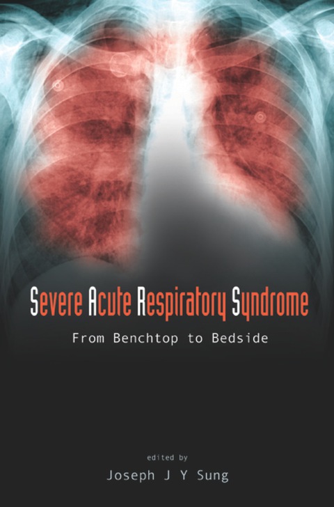 Cover image for book SEVERE ACUTE RESPIRATORY SYNDROME