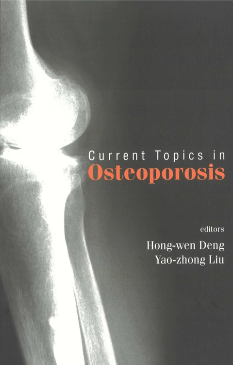 Cover image for book Current Topics In Osteoporosis