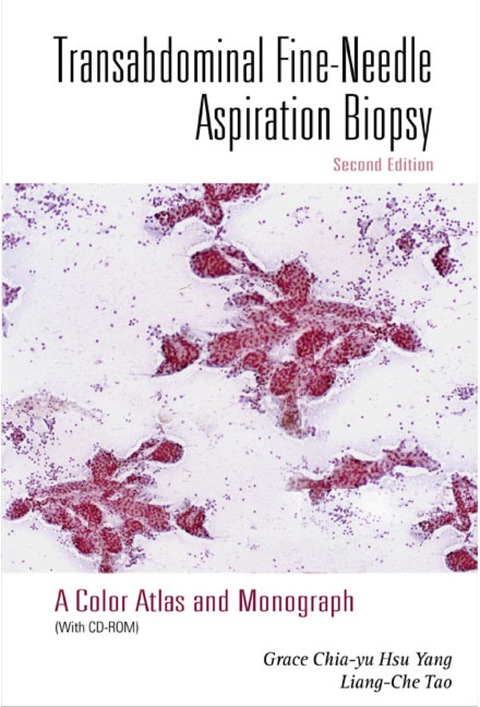 Cover image for book Transabdominal Fine-needle Aspiration Biopsy (2nd Edition): A Color Atlas And Monograph (With Cd-rom)