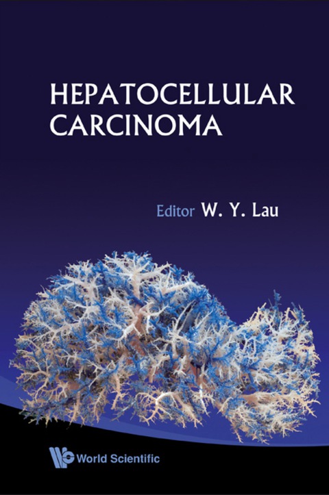 Cover image for book Hepatocellular Carcinoma