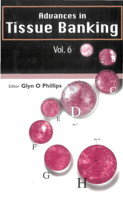 Cover image for book ADVANCES IN TISSUE BANKING (V6)