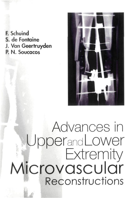 Cover image for book ADVANCES IN UPPER & LOWER EXTREMITY.....