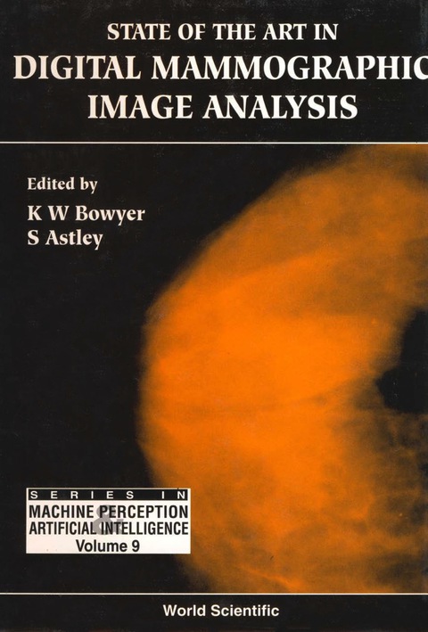 Cover image for book State Of The Art In Digital Mammographic Image Analysis