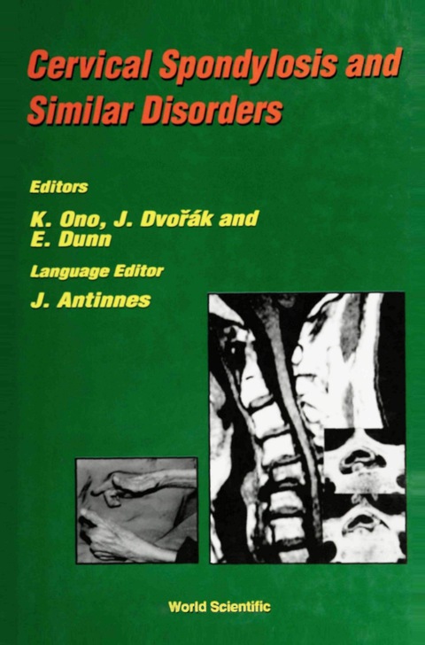 Cover image for book CERVICAL SPONDYLOSIS & SIMILAR DISORDERS