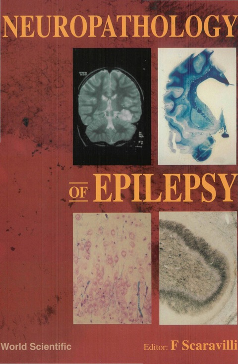 Cover image for book Neuropathology Of Epilepsy