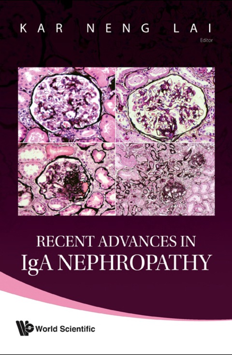 Cover image for book RECENT ADVANCES IN IGA NEPHROPATHY