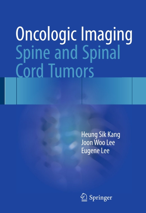 Cover image for book Oncologic Imaging: Spine and Spinal Cord Tumors