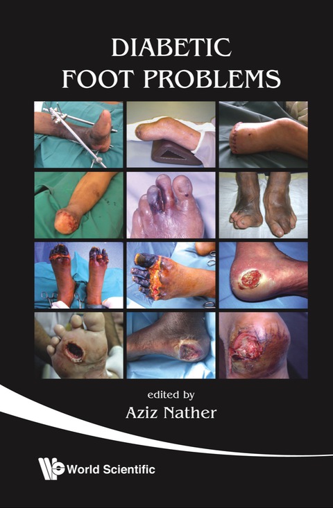 Cover image for book Diabetic Foot Problems