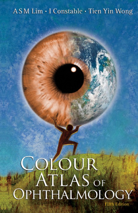 Cover image for book Colour Atlas of Ophthalmology